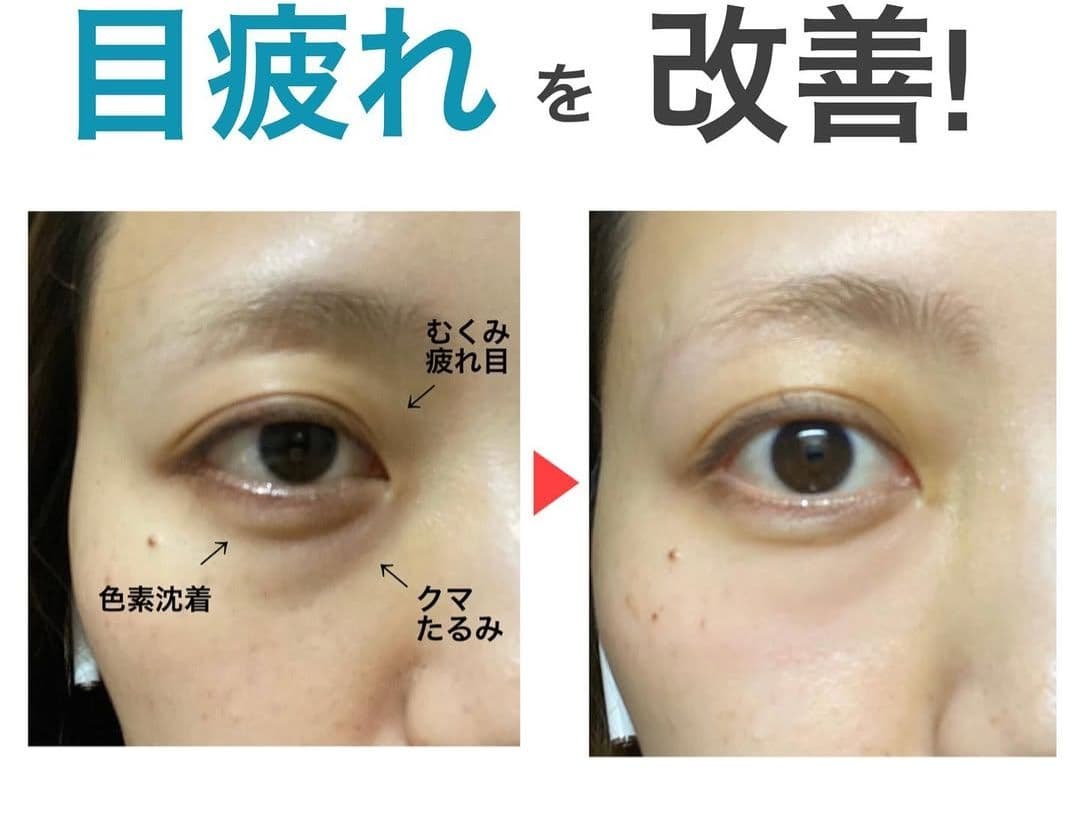 ドットイー 目元専用美顔器